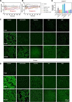 Selenium speciation-dependent cancer radiosensitization by induction of G2/M cell cycle arrest and apoptosis